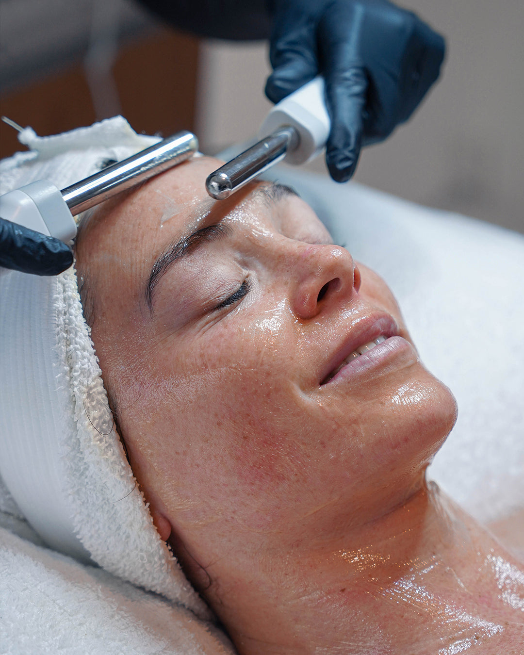 Micro Needling